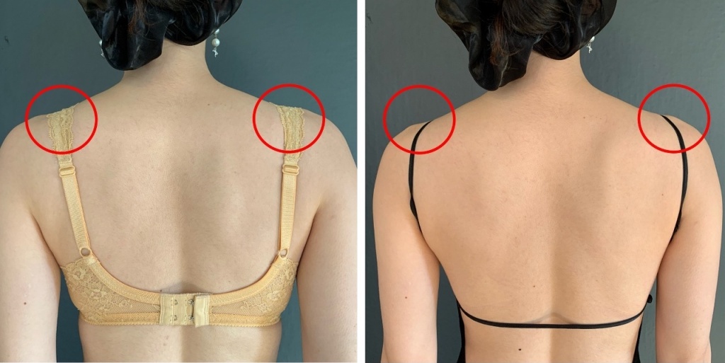 左:一般的なストラップ位置 右:Rosa Open Back Bodyのストラップ位置